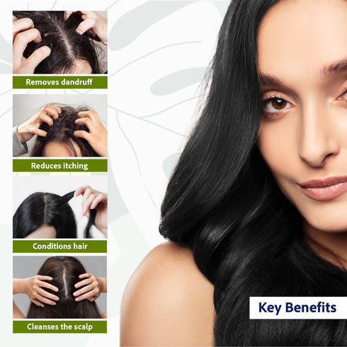 Sri Sri Tattva Anti Dandruff Shampoo 200ml